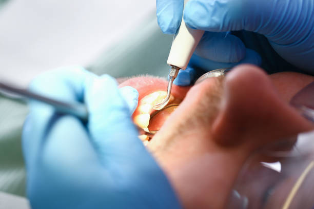 Best Emergency Treatment for Toothache in East Richmond Heights, CA